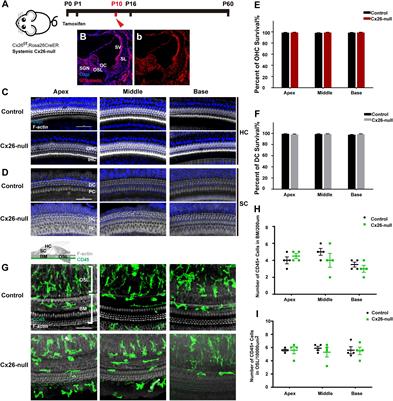 Local Macrophage-Related Immune Response Is Involved in Cochlear Epithelial Damage in Distinct Gjb2-Related Hereditary Deafness Models